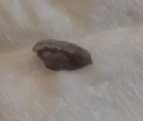 Bug in Toothpaste (1)c.webp